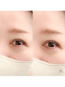 エンズ 代官山(O`s)/オーダーメイドラッシュリフト