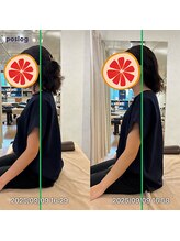 グレフル鍼灸接骨院 整体院 心斎橋/整体/肩こり/マッサージ/腰痛