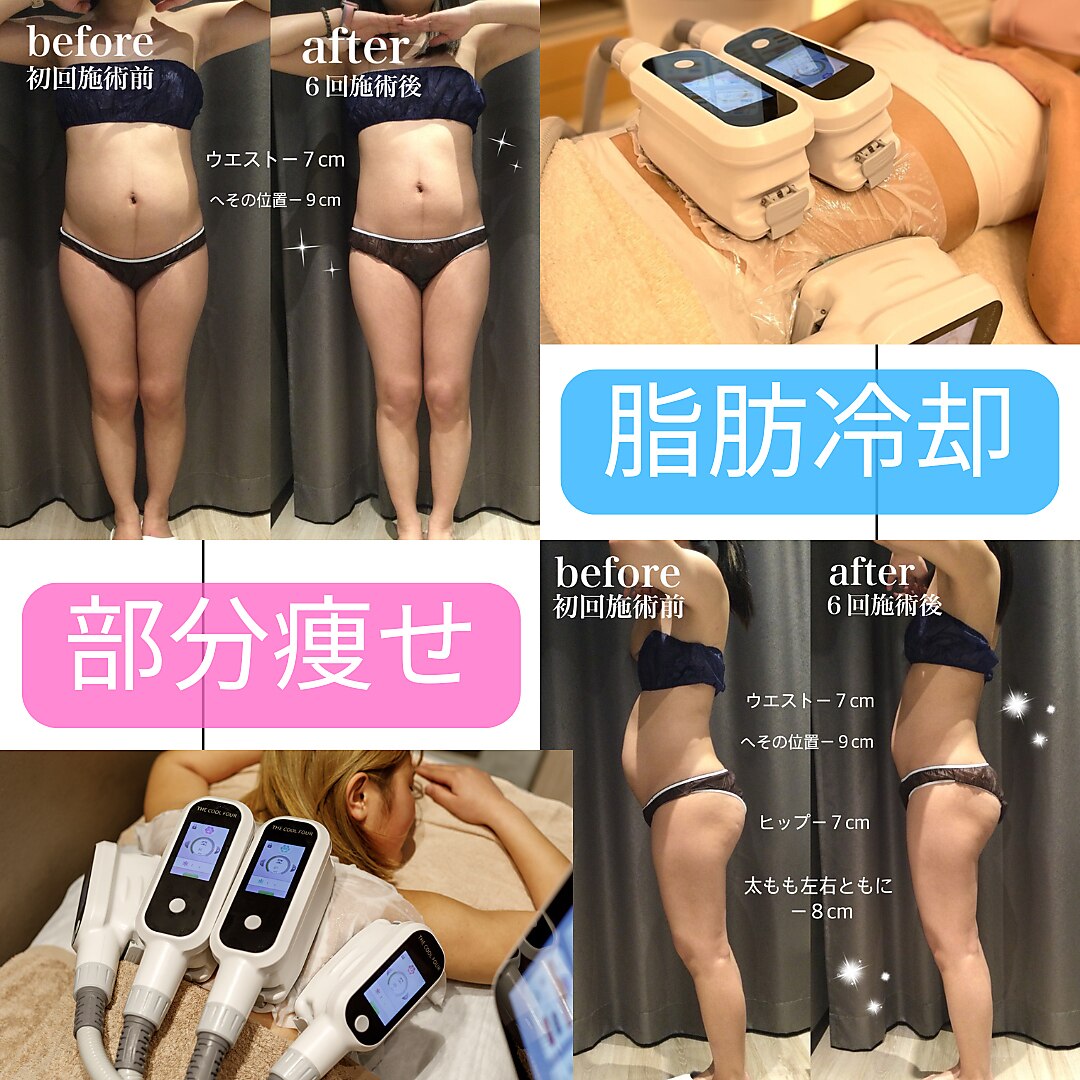 アイ(i)｜ホットペッパービューティー