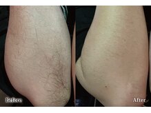 アネル オム 新都心店(ANEL HOMME)/