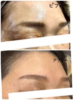 セカンドボックスブルーム(2nd Box BLOOM)/