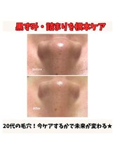トータルビューティー雅/【今ケアするかで未来が変わる】