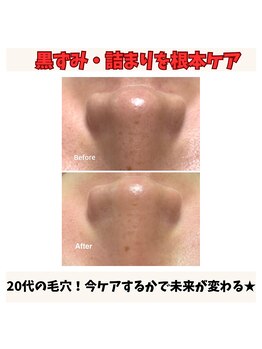 トータルビューティー雅/【今ケアするかで未来が変わる】