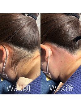 カナウ(KANAU)/うなじワックス（30代女性）