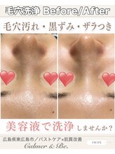 カルマーアンドビー(Calmer & Be.)/【毛穴洗浄】Before/After