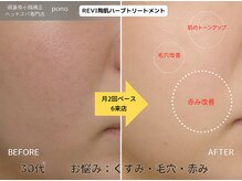 ポノ 甲府本店(pono)/REVI陶肌ハーブトリートメント