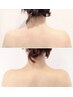 肩凝り改善・巻き肩・肩の歪み・盛り上がった肩解消(痩身スタンプ使用)