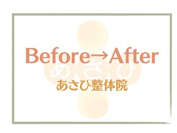 あさひ整体院 日本橋浜町院/施術のビフォーアフター