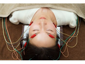 たたら鍼灸整骨院/電気を流す美容鍼