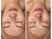 花華サロン(カカサロン)の雰囲気（韓国発次世代ピーリング！ツヤ肌・ハリ感ＵＰを叶える最新肌管理）
