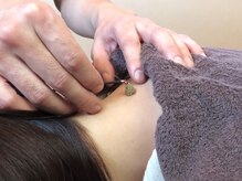 じんわり温かいお灸で、身体の滞りをとっていきます！