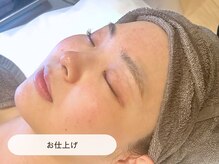 キュレイテッドスキン(CURATED SKIN)/お仕上げ