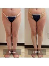 パピヨン(Papillon)/痩せやすい身体に◎