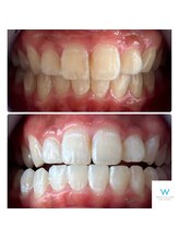 ホワイトニングショップ 奈良生駒店/憧れられる歯へ