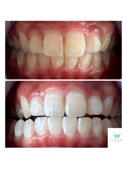 ホワイトニングショップ 奈良生駒店/憧れられる歯へ