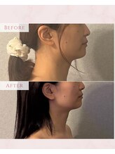 ハチハチ(808)/相模原美容鍼灸院