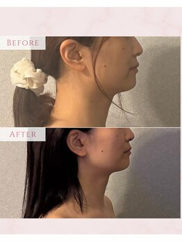 ハチハチ(808)/相模原美容鍼灸院