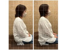 トラスト整体院 小池院/50代/女性/主婦/肩こり、痺れ