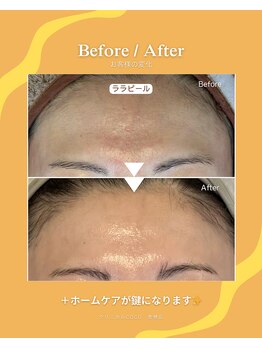 クリニカルココ 香椎店(クリニカルCOCO)/ララピール