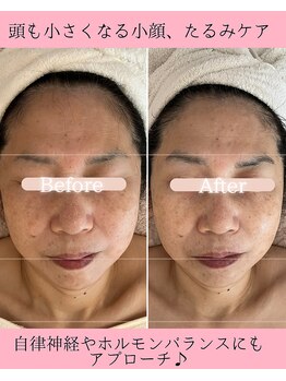 ココロ(COCORO)/頭もお顔も小さくなるエステ