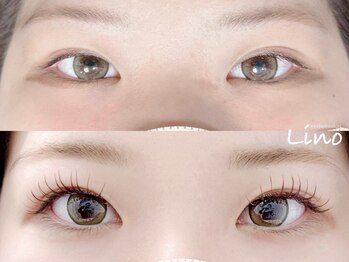 リノ(Lino)の写真/経験豊富なアイリストが丁寧に対応！まつ毛の悩みを解消し、ナチュラルで美しい理想の目元へ♪