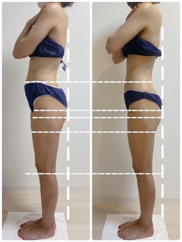 エヌラボ(N.LABO)/