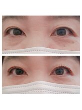 アミークス(Amicus)/似合わせパーマ