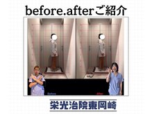 栄光治院 整体院東岡崎/猫背から卒業！正しい姿勢へ