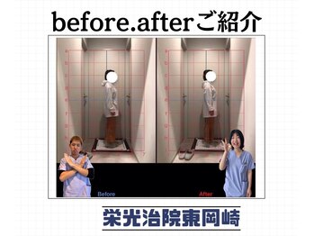 栄光治院 整体院東岡崎/猫背から卒業！正しい姿勢へ