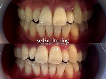 ココロビューティーギャラリー 武蔵小杉(cocorobeauty gallery)/他店で効果を感じられなかった方