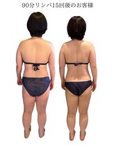 エスエー(SA)/Before/after