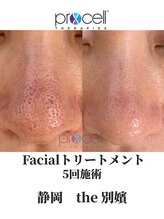 ザ ベッピン(the 別嬪)/毛穴も大得意！プロセル