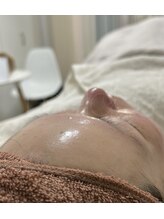 黒ずみ毛穴ケア専門店　melab　【ミラボ】〈毛穴エクストラクション/毛穴ケア〉/韓国ピーリング(プラピール)