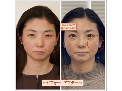 ビューティーパンク 黒田鍼治療院(Beauty Punc)の写真