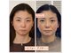 ビューティーパンク 黒田鍼治療院(Beauty Punc)の写真
