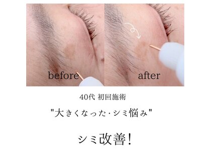 リセット 本山(Reset)の写真