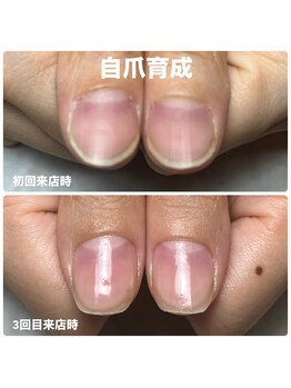 リラ(Rira)の写真/小さい爪や薄い爪のコンプレックスを短期間で見せたくなる縦長爪へ導くケア♪
