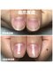 リラ(Rira)の写真/小さい爪や薄い爪のコンプレックスを短期間で見せたくなる縦長爪へ導くケア♪