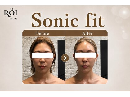 ロイボーテ(ROI Beaute)の写真