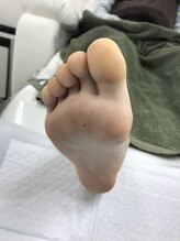 ドクターネイル爪革命 北千住店/たこ、うおのめケア　足湯あり