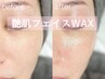 【顔WAX 】産毛 ムダ毛 角質 黒ずみ除去 つるつるフェイス