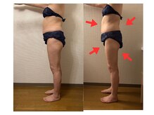 レーヴリゼ(Revelise)/血流改善/温熱リンパマッサージ