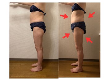 レーヴリゼ(Revelise)/血流改善/温熱リンパマッサージ