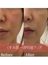 ザモア 福岡天神(THE MORE)/ホワイトシャイン【全身美白】