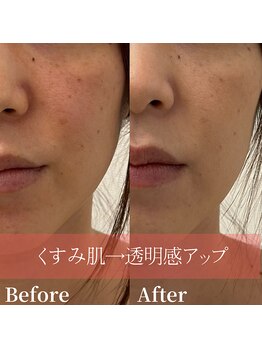 ザモア 福岡天神(THE MORE)/ホワイトシャイン【全身美白】