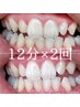 【人気No.3】誰でも簡単白い歯に! 12分×2回 セルフホワイトニング 4800円