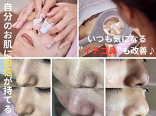 シャイニー(SHINY)