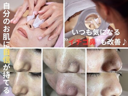 シャイニー(SHINY)の写真