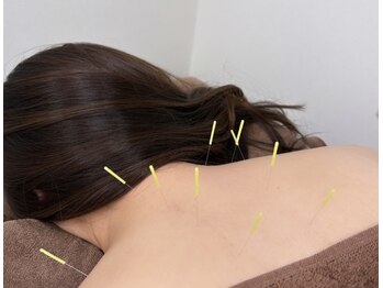 ブロッサム(Blossom)/鍼灸×整体で凝りや痛みを改善