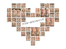 ケアナ 梅田店(CareNa)/アフターカウンセリング【梅田】